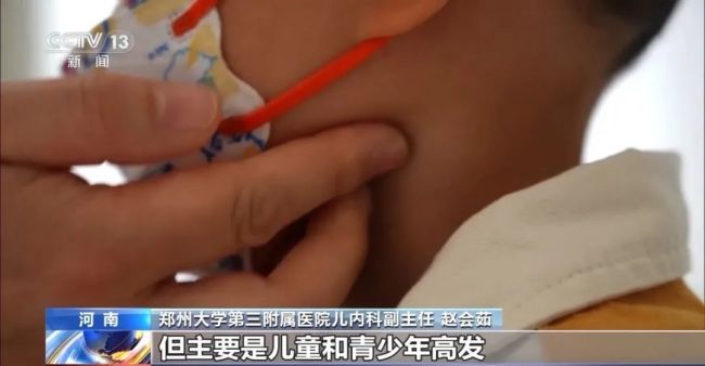 4岁孩子高烧不退，竟然患上“亲吻病”，症状速查4岁孩子高烧不退，竟然患上“亲吻病”，症状速查