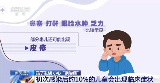 4岁孩子高烧不退，竟然患上“亲吻病”，症状速查4岁孩子高烧不退，竟然患上“亲吻病”，症状速查