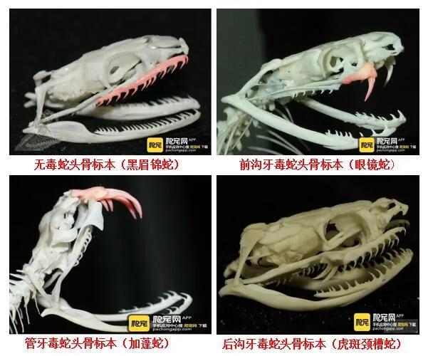 三亚被蛇咬伤致死女子伤口曝光 家属质疑医院误诊延误治疗